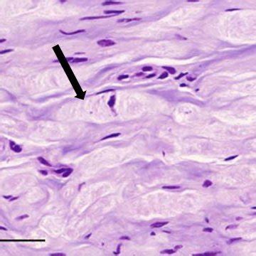 4 -Photomicrograph of a longitudinal section of the left medial palmar ...