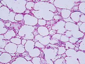 Pleural Epithelial Cells Give Insight Into Mechanical Stresses in Lung