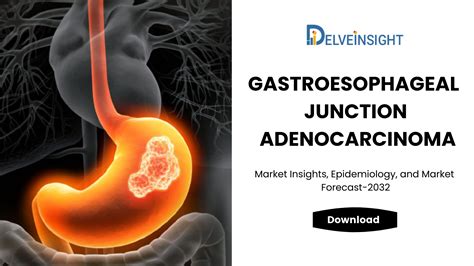 What is the Gastroesophageal Junction Adenocarcinoma Treatment Market ...