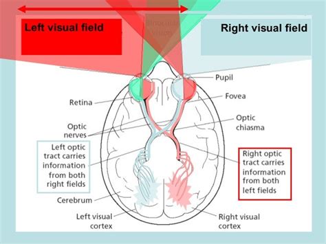 🎉 Split brain patients. Split Brain Patients. 2019-02-22