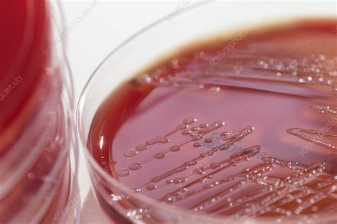 Streptococcus pyogenes bacteria culture - Stock Image - C029/1367 - Science Photo Library