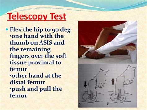 Examination of hip,final