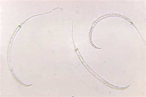 Images: Human Parasites Under the Microscope | Live Science