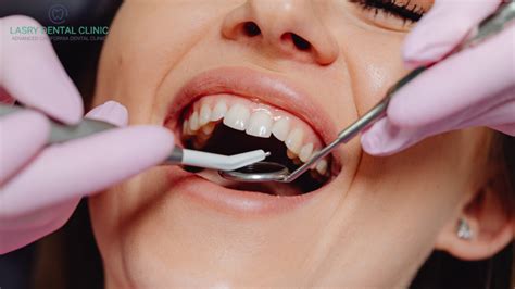 Gum Graft Surgery Cost, Procedure, and Recovery Timeline