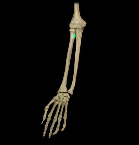 Radial Tuberosity : Its surface is divided into a posterior, rough ...