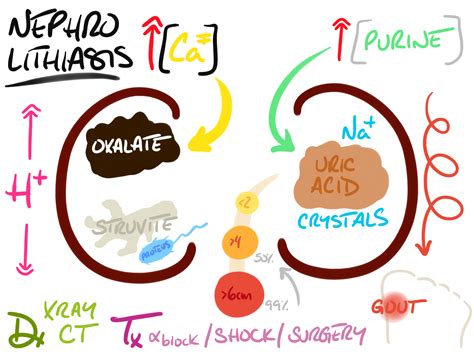 Nephrolithiasis – The Other Library.