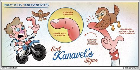 Infectious tenosynovitis | Nursing mnemonics, Nursing notes, Nurse