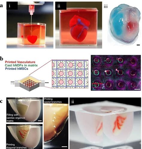 3D printing of large-scale functional tissues or organs: (a) (i) 3D ...