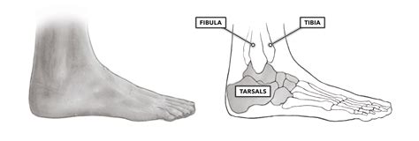 Ankle Internal Rotation