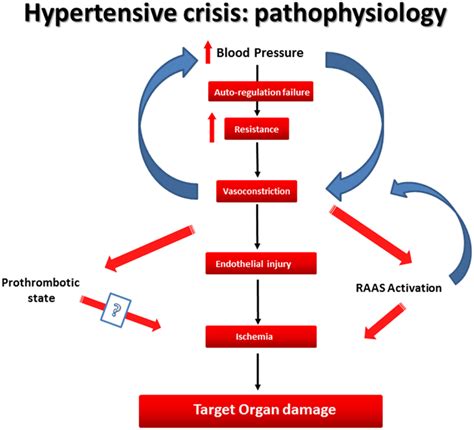 Pathophysiology Of Hypertension Made Easy