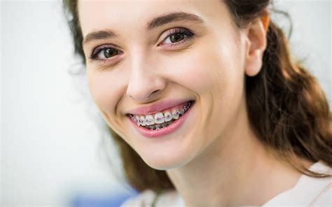 Orthodontics in Phoenix, AZ | Smile Dental Clinics