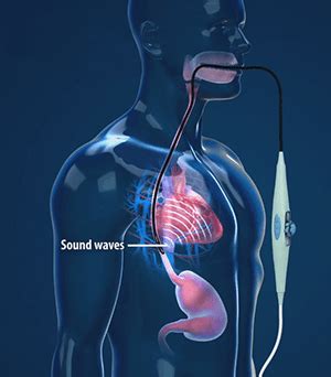 Transesophageal Echocardiography TEE Leesburg | Heart Disease Lady Lake, Lake County FL