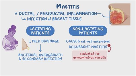 Mastitis: Clinical sciences - Osmosis Video Library