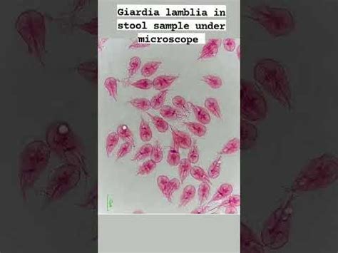Giardia Lamblia In Stool Sample Decoration Drawing | My XXX Hot Girl