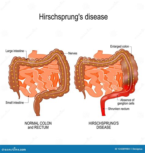 Digestion And Peristalsis. Gastrointestinal Peristalsis Diagram. Human Digestive System Stock ...