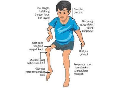 Poliovirus Symptoms