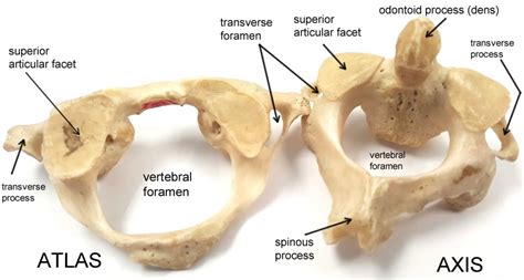 Atlas Vertebrae Anatomy