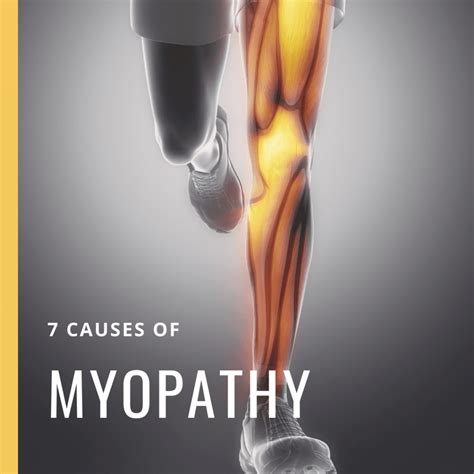 7 Causes of Myopathy - Premier Neurology & Wellness Center