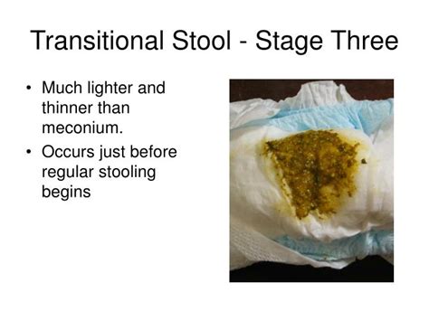 PPT - Meconium: A Sticky Situation PowerPoint Presentation - ID:1201418