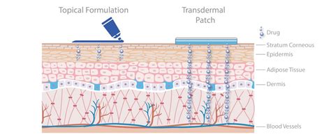 Topical and Transdermal Drug Products: Making the difference through transdermal delivery systems