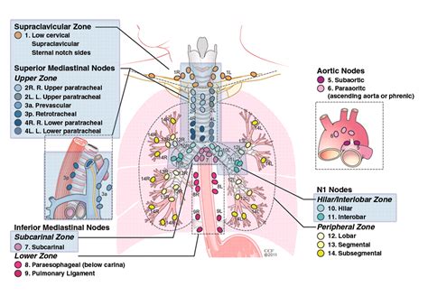 Mediastinal Lymph Node Staging: From Noninvasive to Surgical | AJR