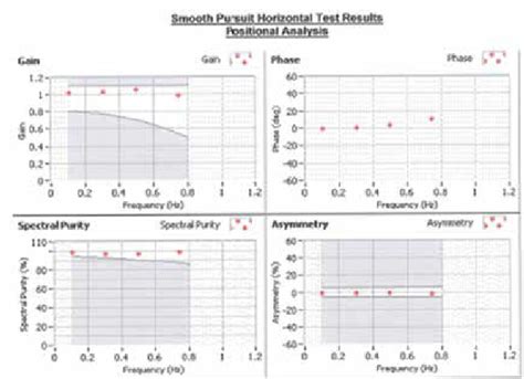 Horizontal smooth pursuit test results demonstrating normal function.... | Download Scientific ...