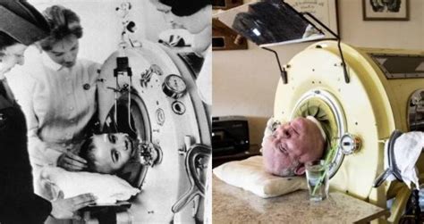 Meet Paul Alexander, The Man Who’s Lived In An Iron Lung For 70 Years ...