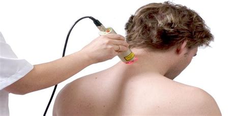 Benefits of acupuncture for treatment of back pain in Delhi | by ...