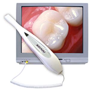 Intraoral camera in dentistry | Dental Care of Chino Hills