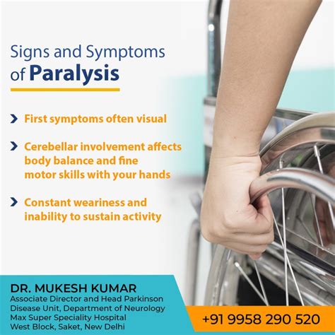 Paralysis Treatment in Delhi Paralysis Specialist Doctor in Delhi