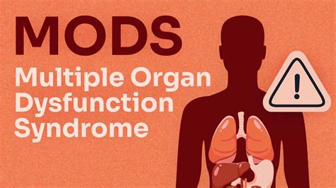 Multiple Organ Dysfunction Syndrome | Ausmed