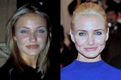 Cameron Diaz Plastic Surgery Before And After Photos - CelebLens.Com