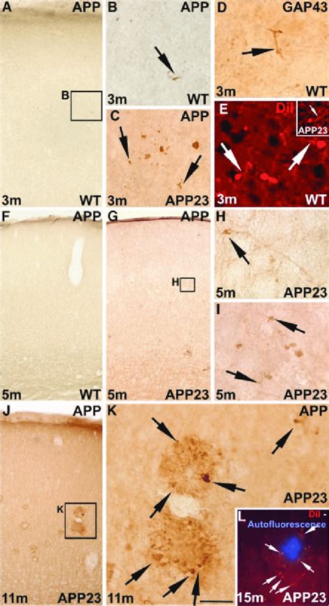 Sprouting and degenerating axons in the frontocentral cortex of ...