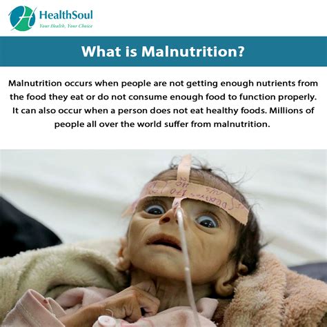 Malnutrition : Causes, Symptoms, Diagnosis and Treatment