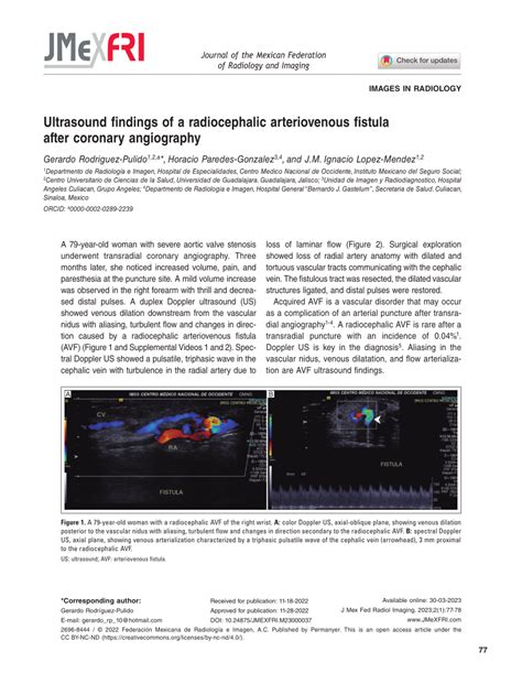 (PDF) Ultrasound findings of a radiocephalic arteriovenous fistula after coronary angiography