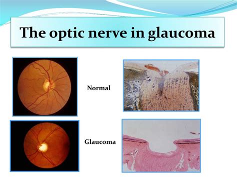 PPT - Fundoscopy Skills PowerPoint Presentation, free download - ID:4312109