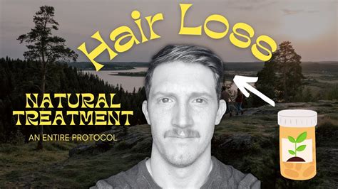 Natural Hair Loss Prevention For Men | An Entire Protocol - YouTube