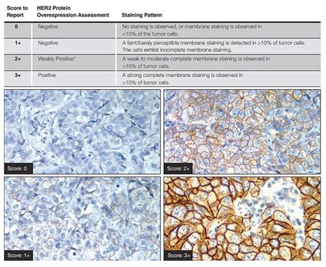 Biphasic Mesothelioma Treatment Telegra Ph