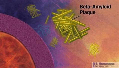 Cannabinoids May Reduce Alzheimer's Proteins From Brain Cells - Neuroscience News