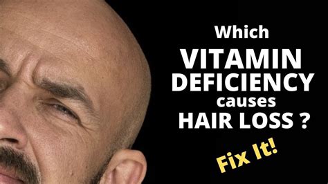 Which Vitamin Deficiency Causes Hair Loss? Learn to Get Rid of Each Vitamin Deficiency & Regrow ...