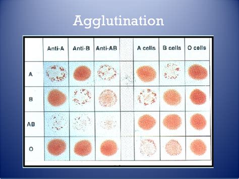 Topic - The Immune System