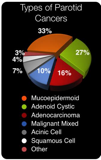 types-of-parotid-cancers.png 338×532 pixels | Cancer, Parotid gland ...