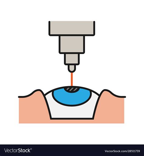 Eye Surgery Clipart