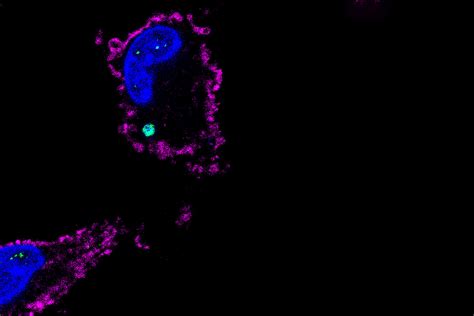 Cell death protein also damps inflammation