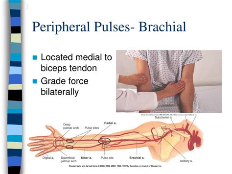 PPT - Heart/Neck Vessels & Peripheral Vascular/Lymphatics PowerPoint Presentation - ID:4071591