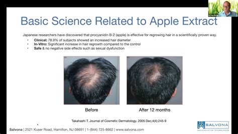 SalSphere® Natural Hair Growth Promoter - YouTube