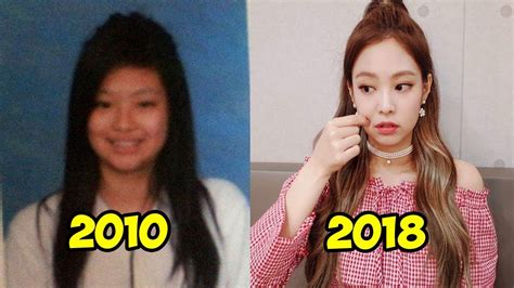 Jennie Kim Before And After