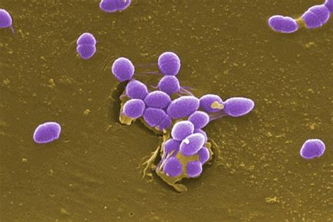 Enterococcus faecalis: A Comprehensive Guide