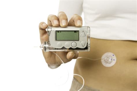 insulin pump - The Johns Hopkins Patient Guide to Diabetes