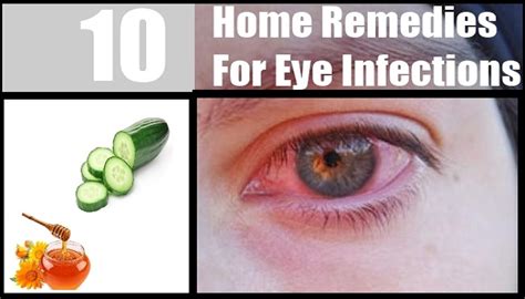 Easy and effective Home Remedies for Eye Infection! | Netmarkers- Submit Original Articles, Stories